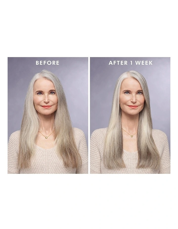 Treatment 50ml image 4