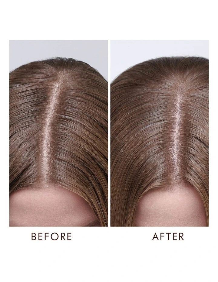 Dry Scalp Treatment 45ml image 5