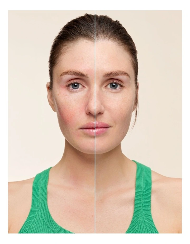 Radiant Complexion SOS Cream Corrective Green 30ml image 5