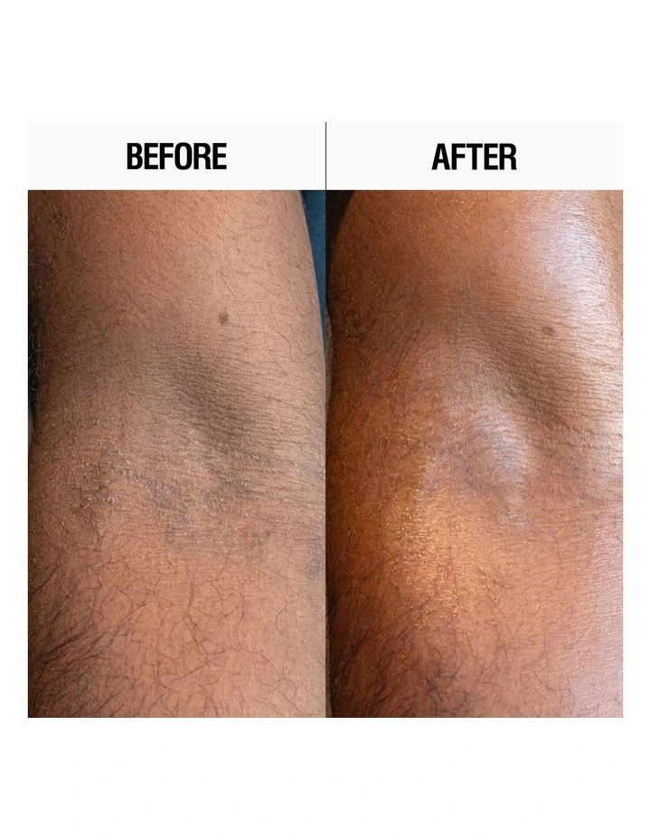 Resurfacing Targeted Body Lotion 300ml image 4