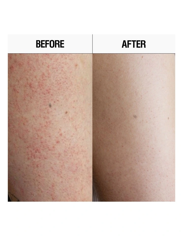 Resurfacing Targeted Body Cleanser 300ml image 4