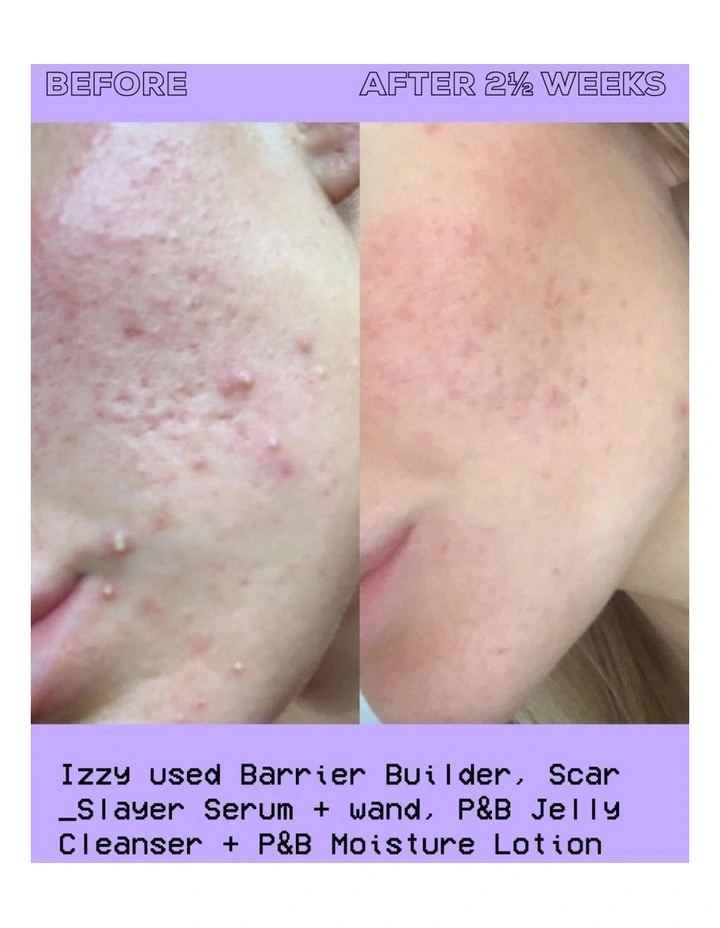 Purify And Brighten Moisture Lotion 95ml image 3