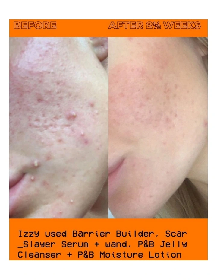 The Scar Slayer Facial Serum 30ml image 3