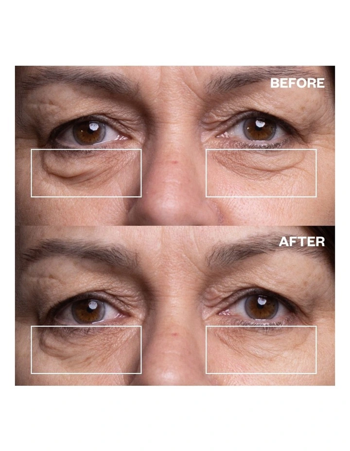 Eye Wrinkle Patches - 3 Pairs of Patches image 3