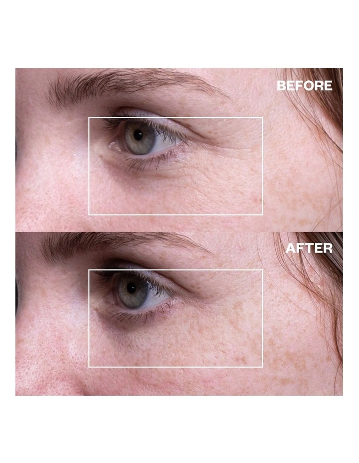 Eye Wrinkle Patches - 3 Pairs of Patches image 5