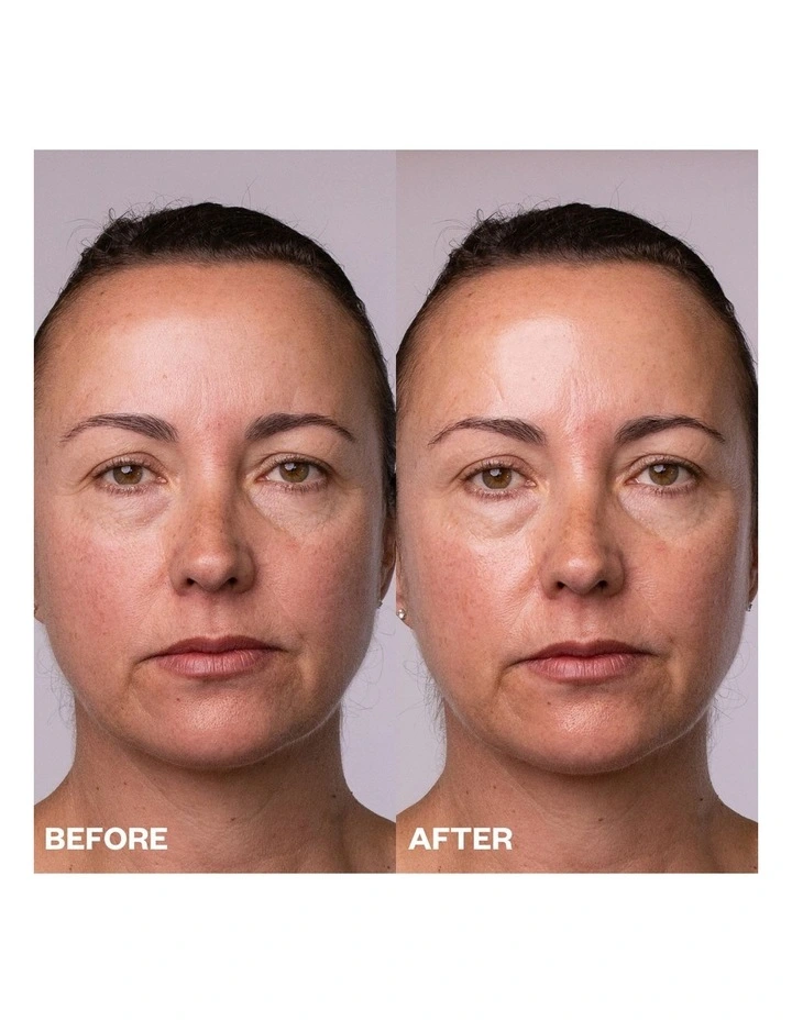 Face, Neck & Decolletage Polishing Peel Pads - 5 Towelletes image 3