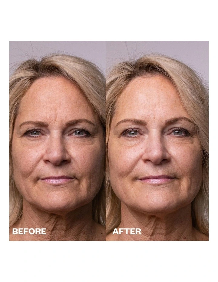 Face, Neck & Decolletage Polishing Peel Pads - 5 Towelletes image 6