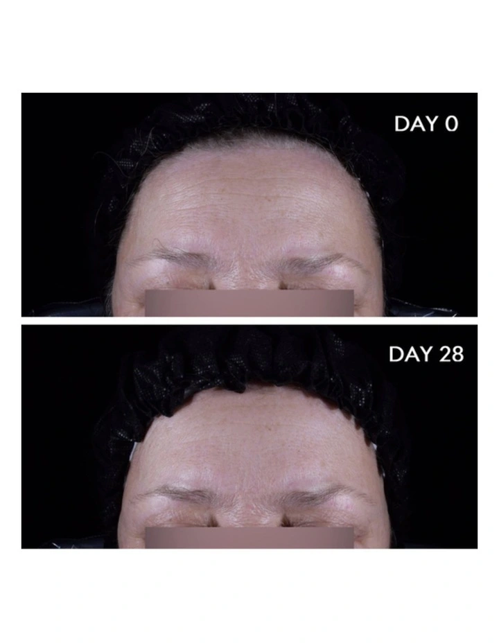 Hydrabio Hyalu+ Plumping Hydrating Serum With Hyaluronic Acid 30ml image 5