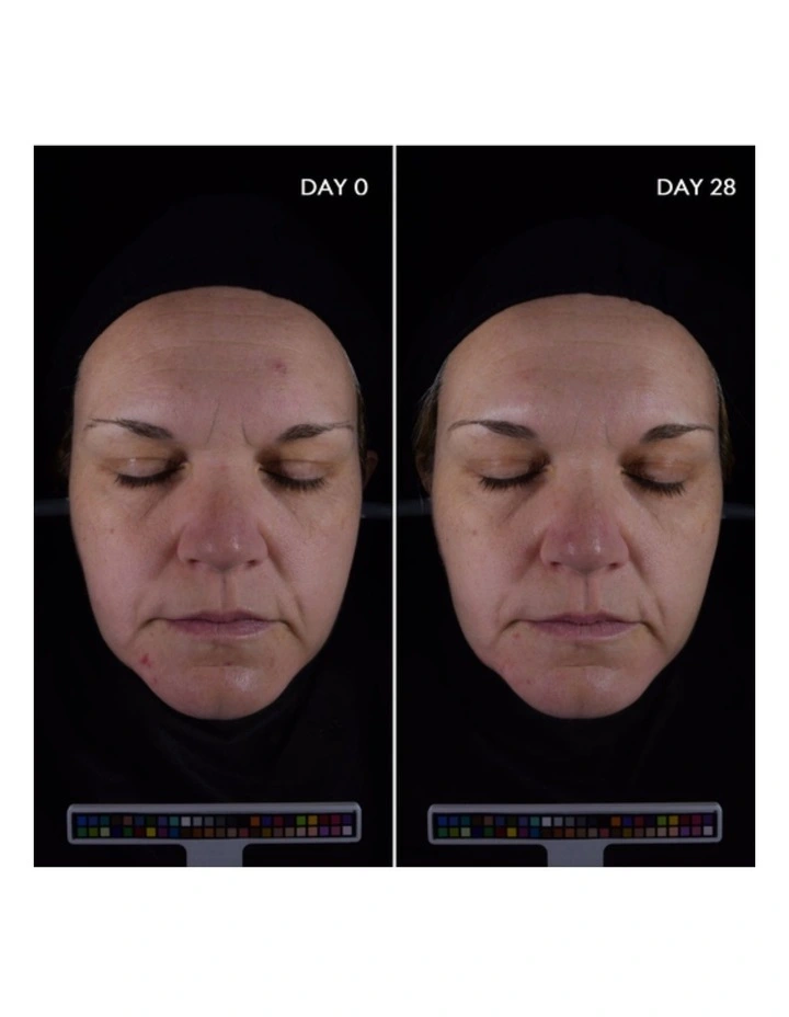 Sebium Anti-Blemish Hydrating Serum 30ml image 6