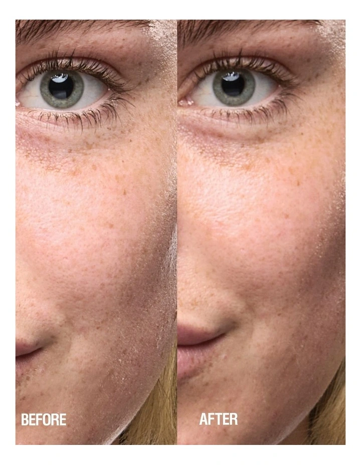 Skin Renewal Serum 25ml image 5