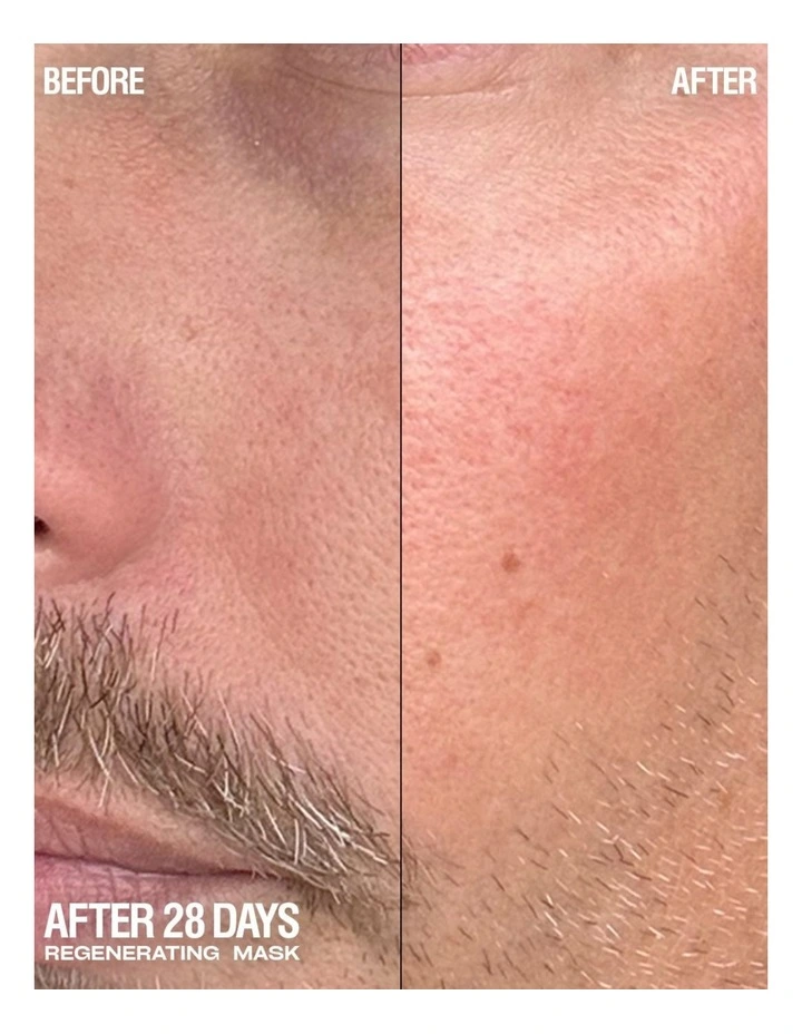 Regenerating Gel Mask 75ml image 5