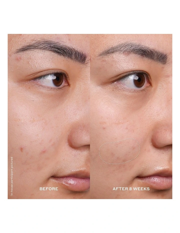 Banana Bright Vitamin C Serum 30ml image 3