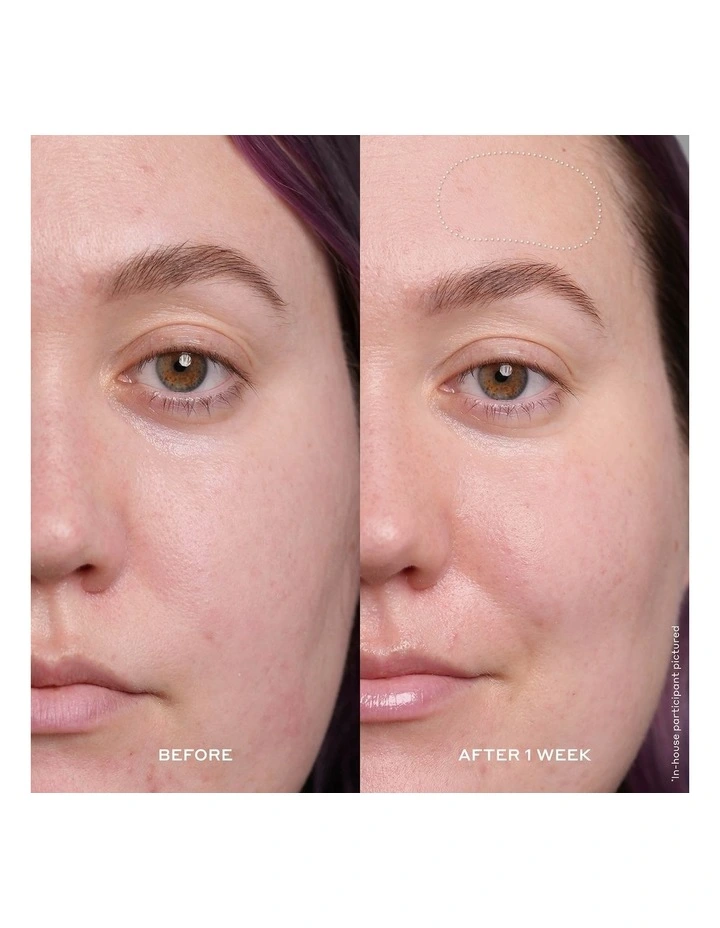 Banana Bright Vitamin C Serum 30ml image 4