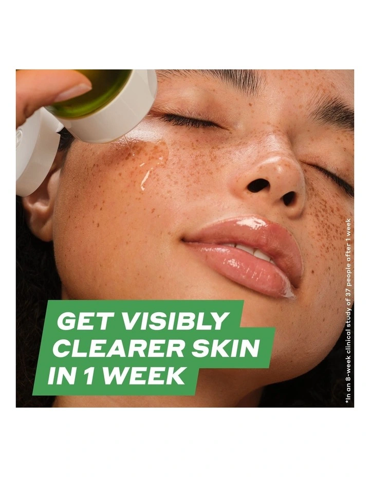 Detox Drops 2% Salicylic Acid Anti-Blemish Toner image 2