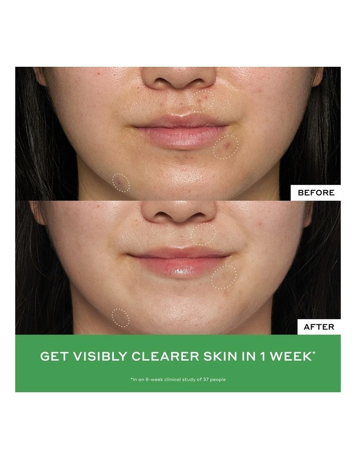 Detox Drops 2% Salicylic Acid Anti-Blemish Toner image 3