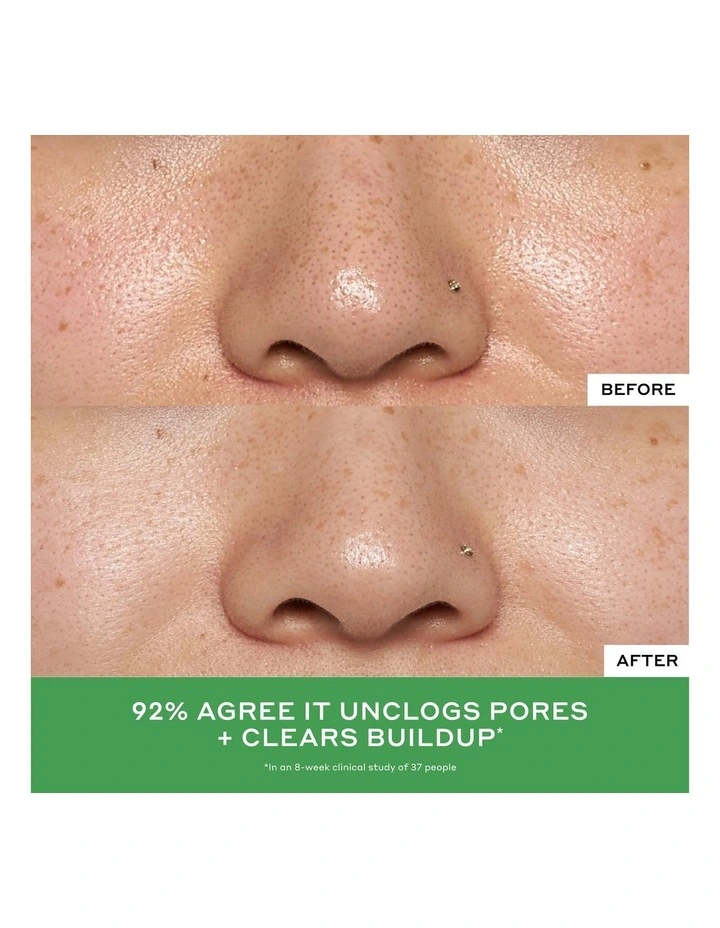 Detox Drops 2% Salicylic Acid Anti-Blemish Toner image 4