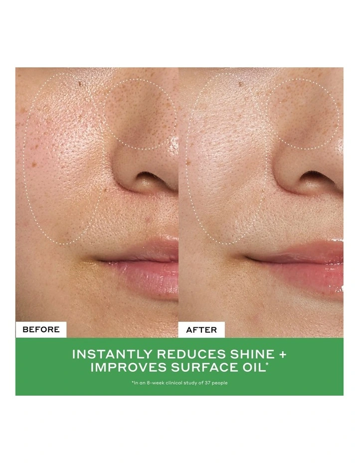 Detox Drops 2% Salicylic Acid Anti-Blemish Toner image 5
