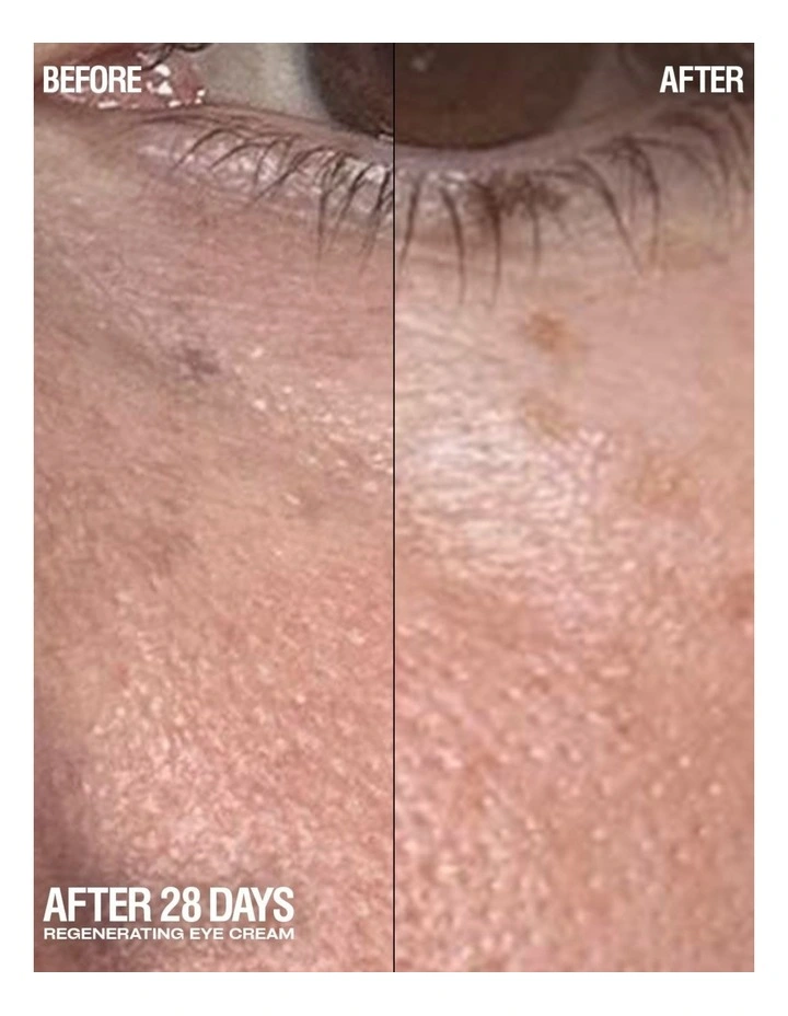 Regenerating Eye Cream 15ml image 5