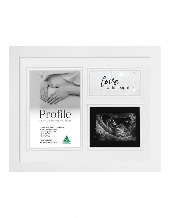 Baby Ultrasound Timber Photo Frame 8x10 in White image 1