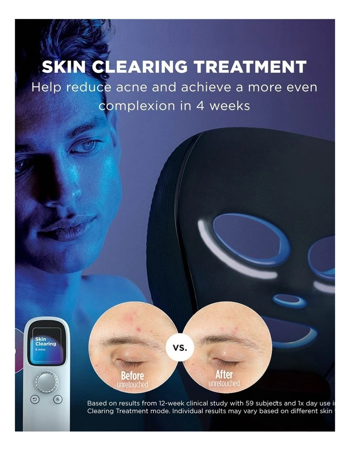 CryoGlow Cooling + LED Face Mask FW312PLANZ image 3