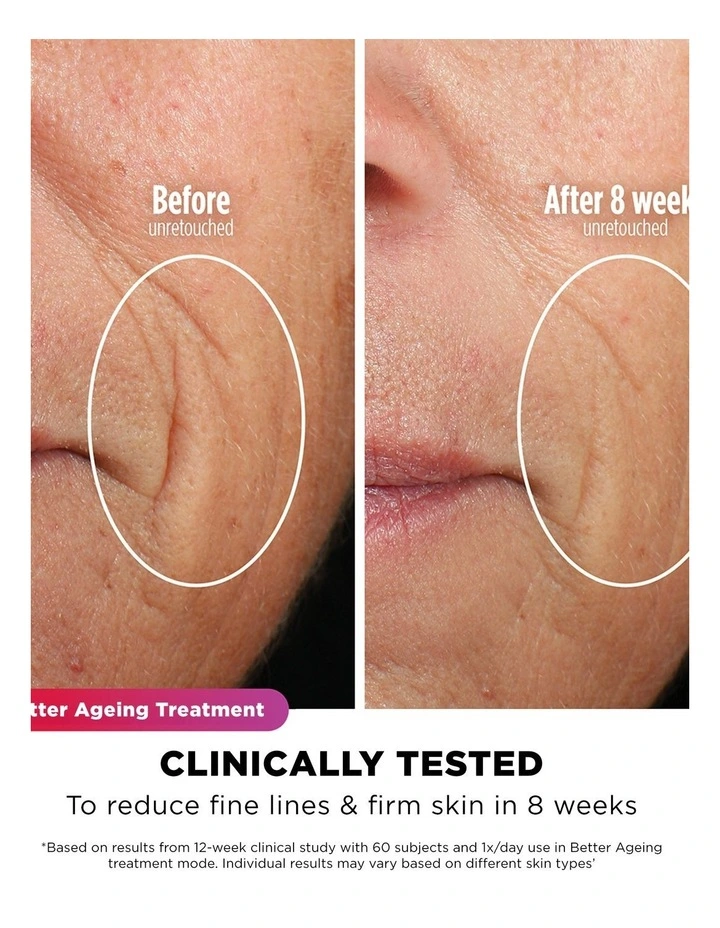 CryoGlow Cooling + LED Face Mask FW312PLANZ image 6