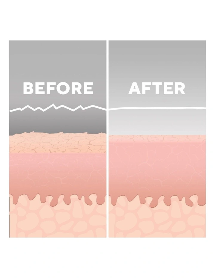 Radiance Microdermabrasion With Cooling MD-1000-AU in Multi image 3