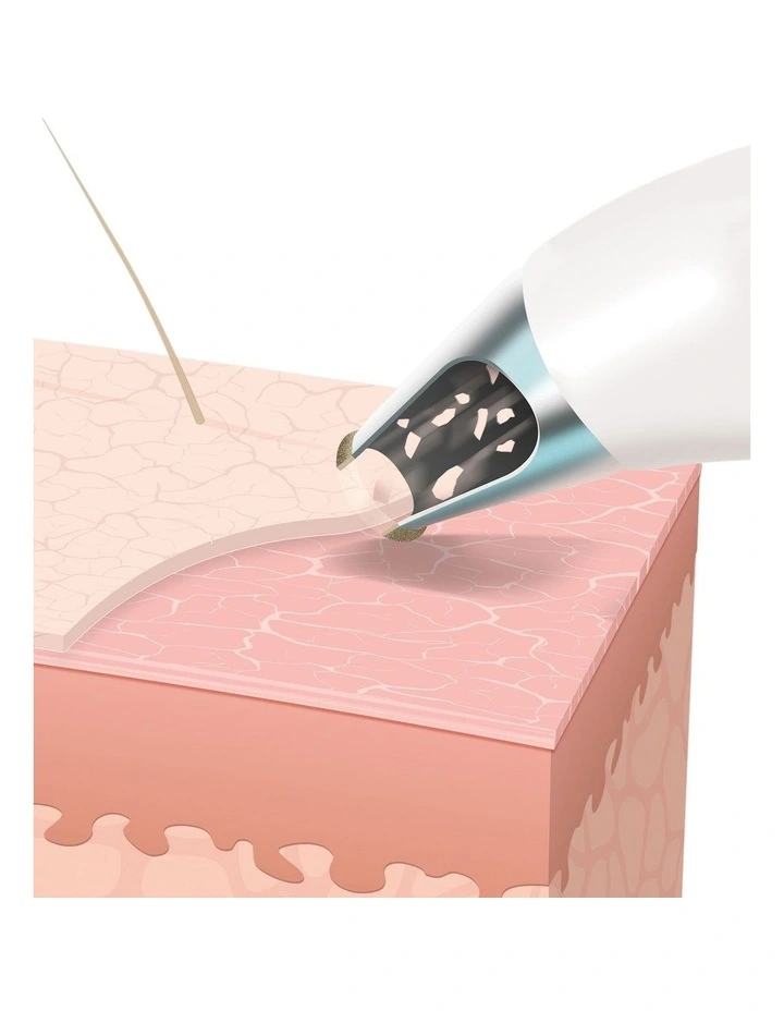 Radiance Microdermabrasion With Cooling MD-1000-AU in Multi image 4