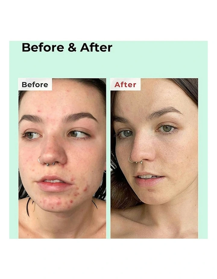 BHA Blackhead Power Liquid image 5