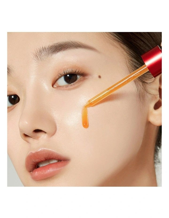 Red Acne Succinic Acid Peel image 5