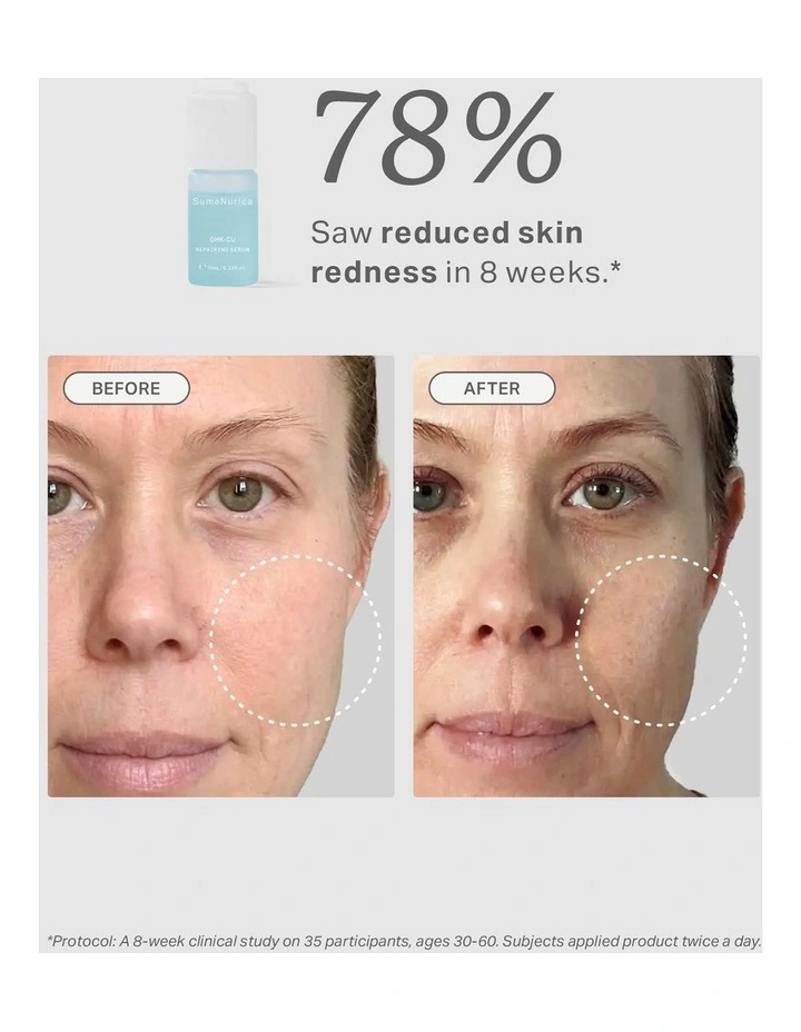 GHK-Cu Repairing Serum 30ml image 3