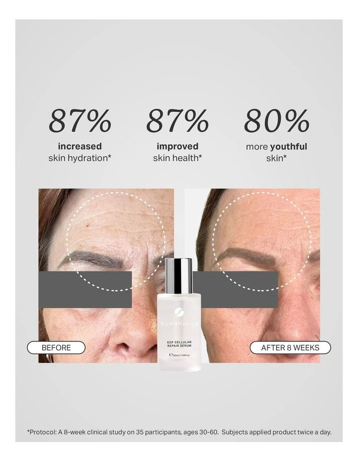 EGF Cellular Repair Serum 50ml image 6