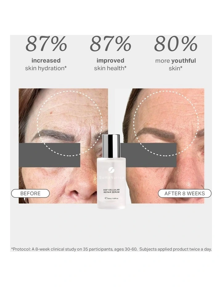 EGF Cellular Repair Serum 50ml image 6