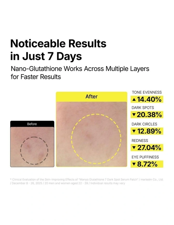 Glutathione 7 Dark Spot Serum Patch image 5