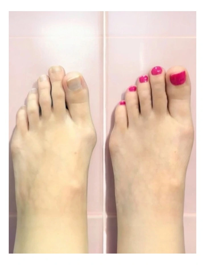After Party Silicon Toe Socks Separators in Black image 3